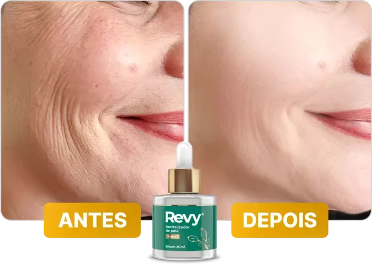 antes-depois-1