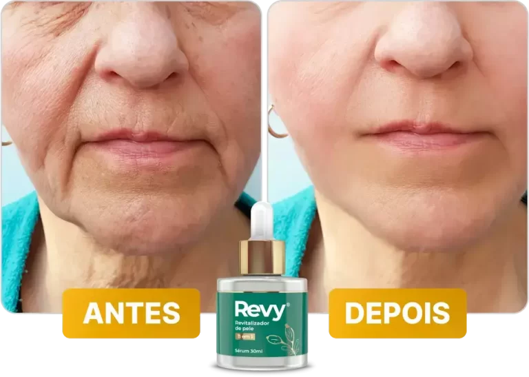 antes-depois-3