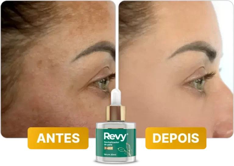 antes-depois-5